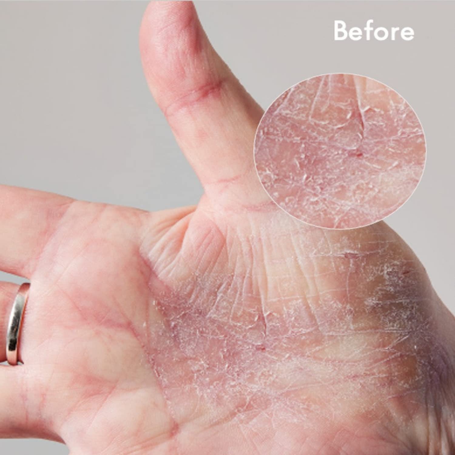 Lanolips Deep Moisture Rescue Duo – 101 Dry Skin Super Cream (2.02 oz) & Golden Dry Skin Salve (25 g), All-Over Hydration & Repair - Image 8