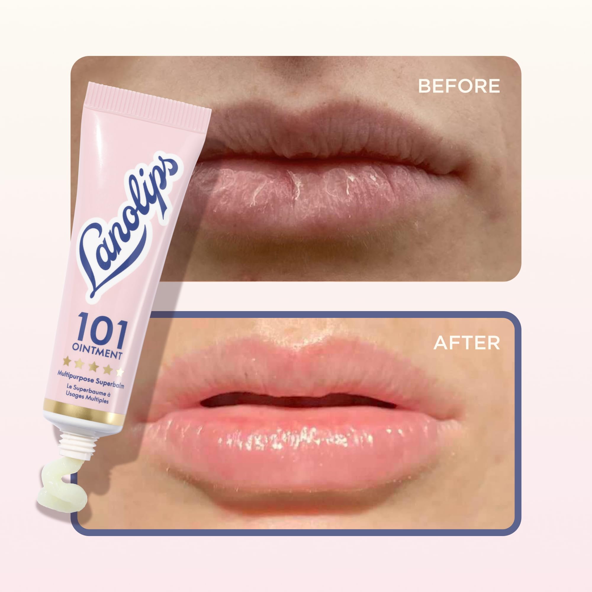 Lanolips Hydration Heroes Set – 101 Ointment (0.52 oz) + 101 Dry Skin Super Cream (2.02 oz), Ultra-Hydrating Lanolin Balm & Whipped Body Moisturizer for Dry Lips, Skin & Cuticles - Image 6