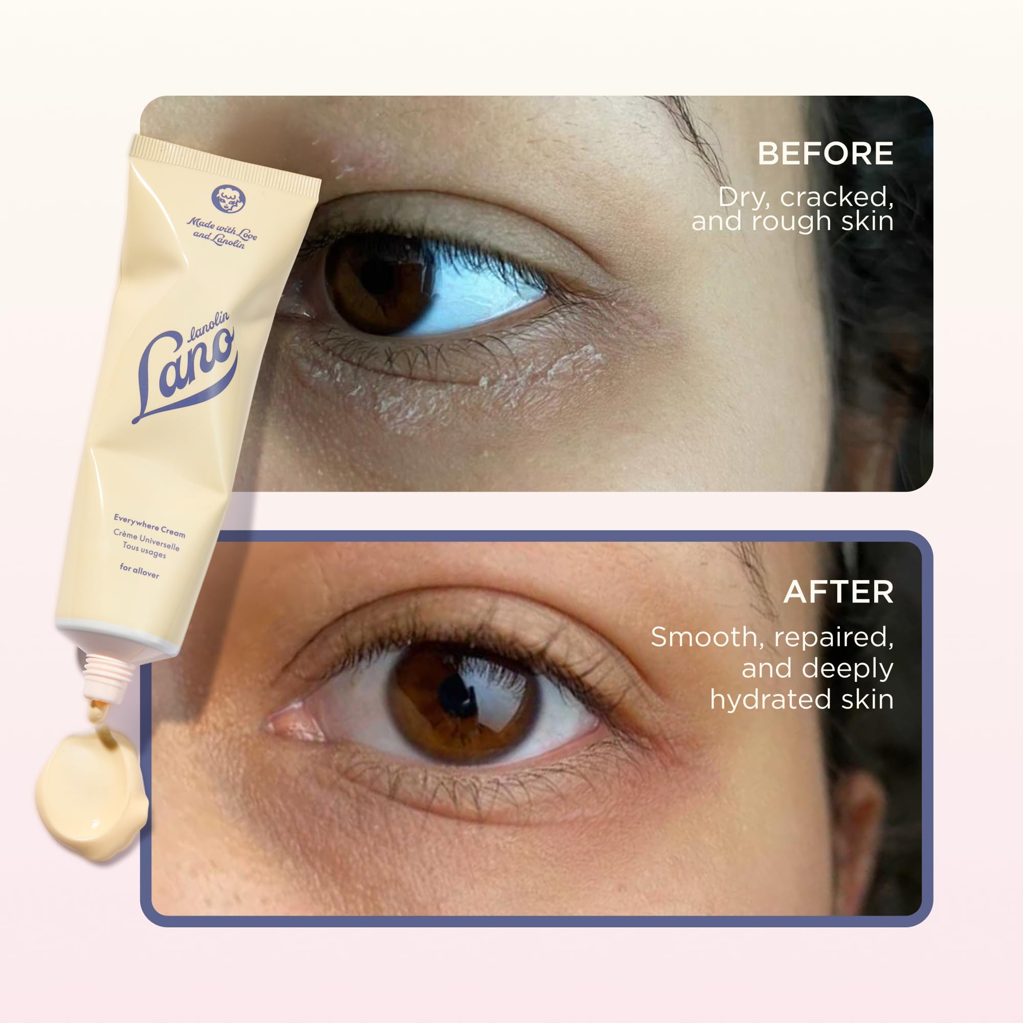 Lanolips Moisture Rescue Duo – Everywhere Cream (85ml) + Golden Dry Skin Salve (25g) – Multi-Purpose Lanolin Moisturizers for Face, Body & Hands - Image 8