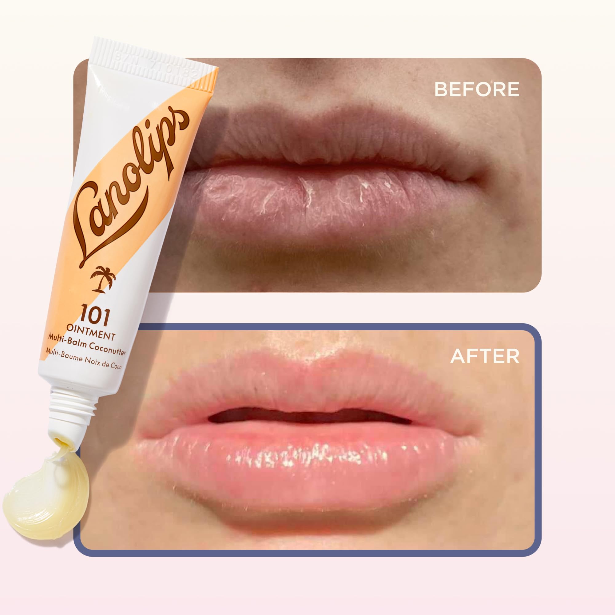 Lanolips 101 Dry Skin Super Cream (2.02 oz) 101 Ointment Coconutter (0.35 oz) – Ultimate Dry Skin Rescue Duo - Image 5