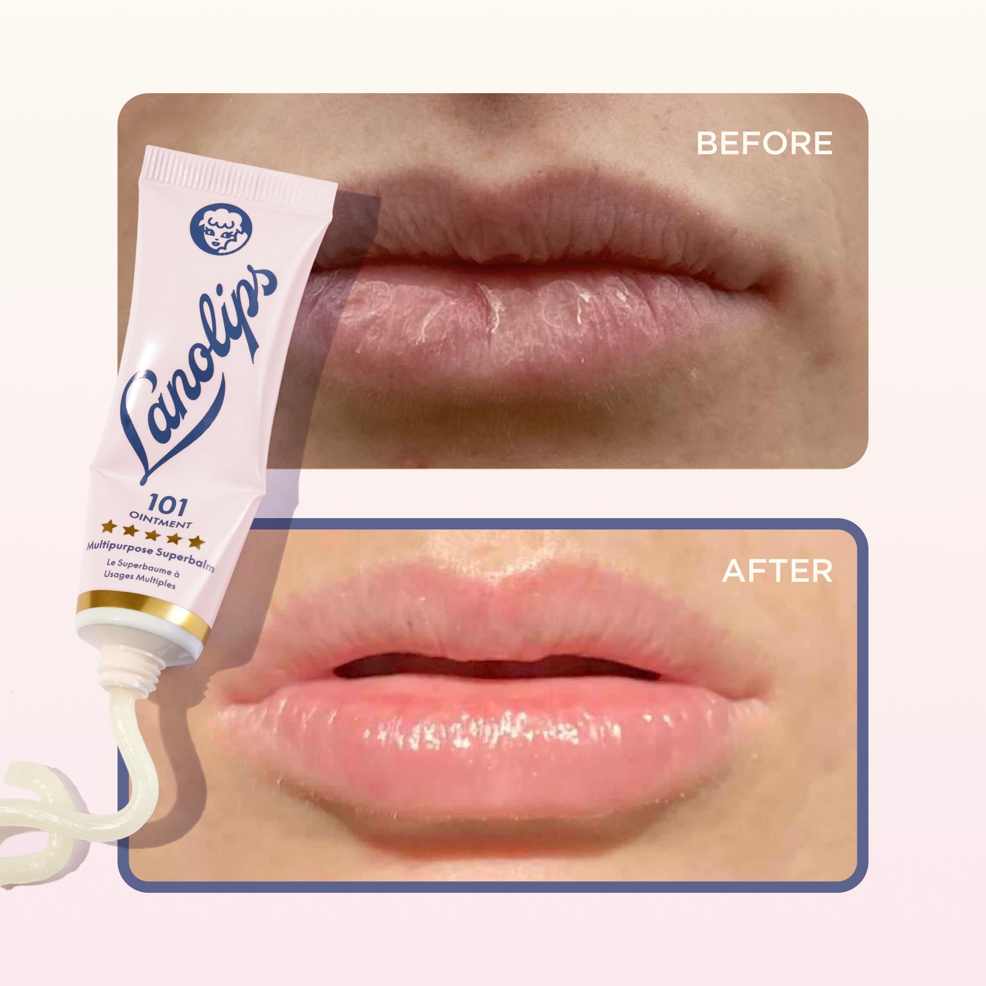 Lanolips Hydration All Over Bundle - 3-Piece Lanolin Balm Set for Dry, Cracked Lips and Skin - Includes 101 Ointment, Golden Dry Skin Salve & Everywhere Multi Cream for Daily Hydration - 3-Piece Set - Image 5