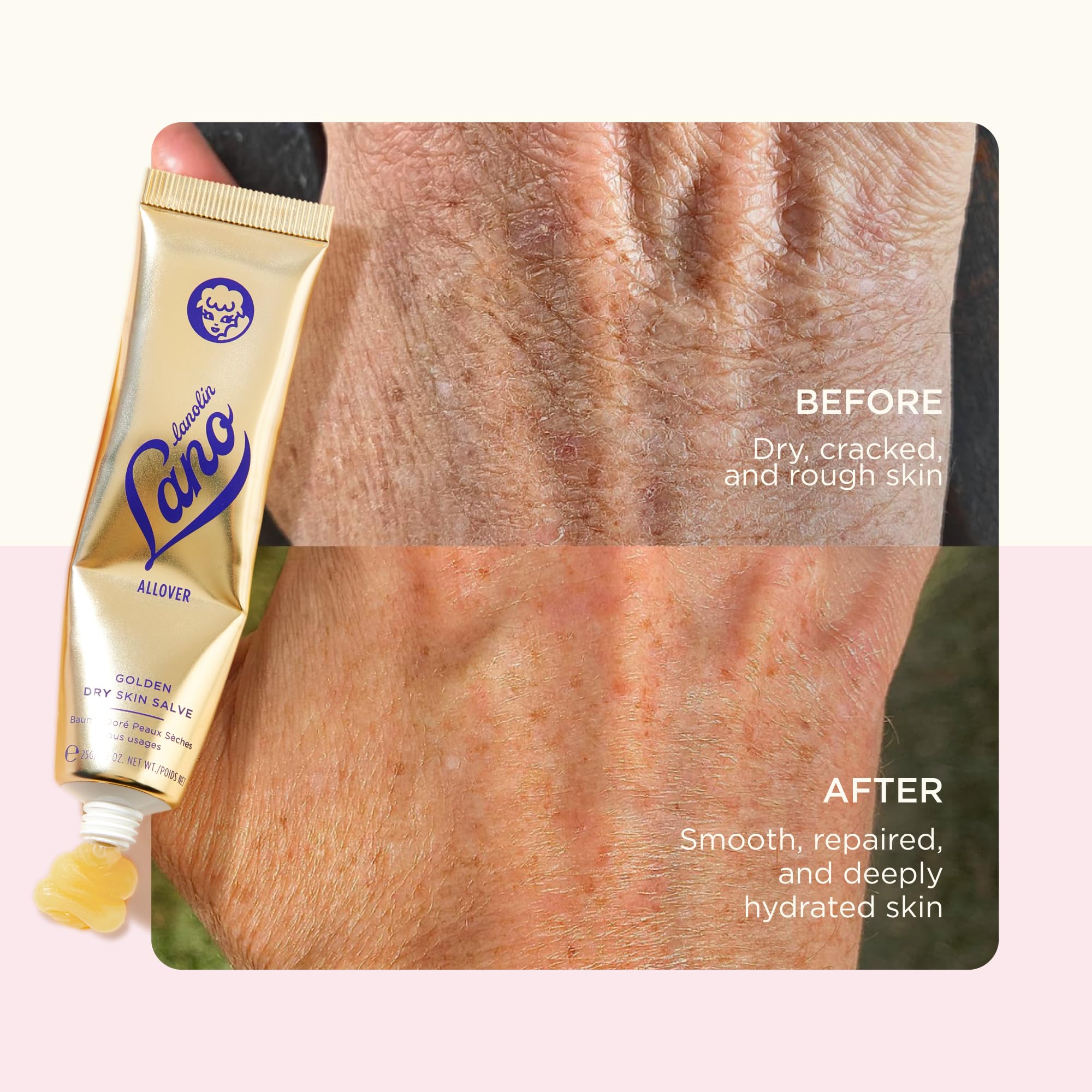 Lanolips Deep Moisture Rescue Duo – 101 Dry Skin Super Cream (2.02 oz) & Golden Dry Skin Salve (25 g), All-Over Hydration & Repair - Image 6