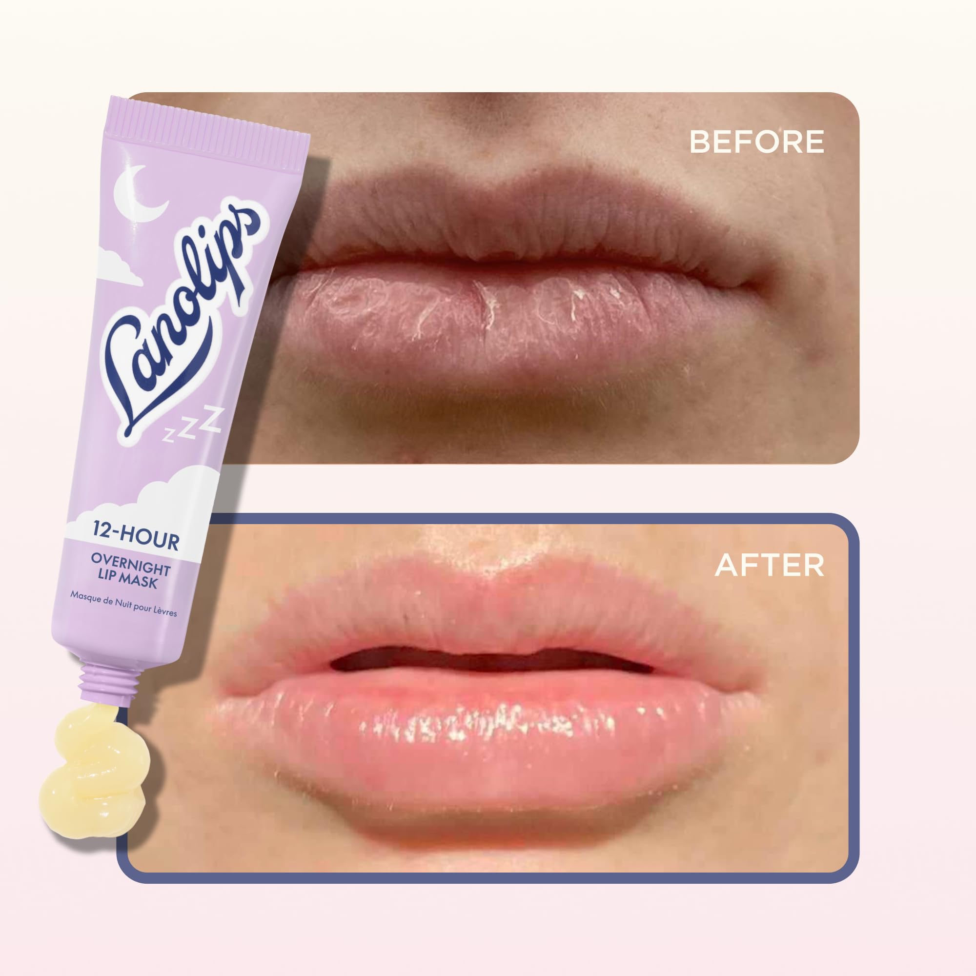 Lanolips Overnight Repair Duo – 12 Hour Overnight Lip Mask (0.52 oz) & Golden Dry Skin Salve (25 g), Deep Hydration + Repair - Image 5